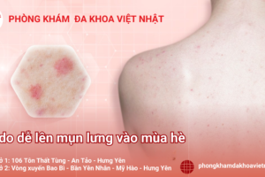LÝ DO DỄ LÊN MỤN LƯNG VÀO MÙA HÈ