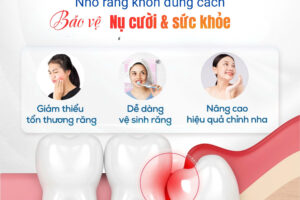 NHỔ RĂNG KHÔN ĐÚNG LÚC – GIẢM ĐAU TỨC THÌ, BẢO VỆ RĂNG MIỆNG LÂU DÀI