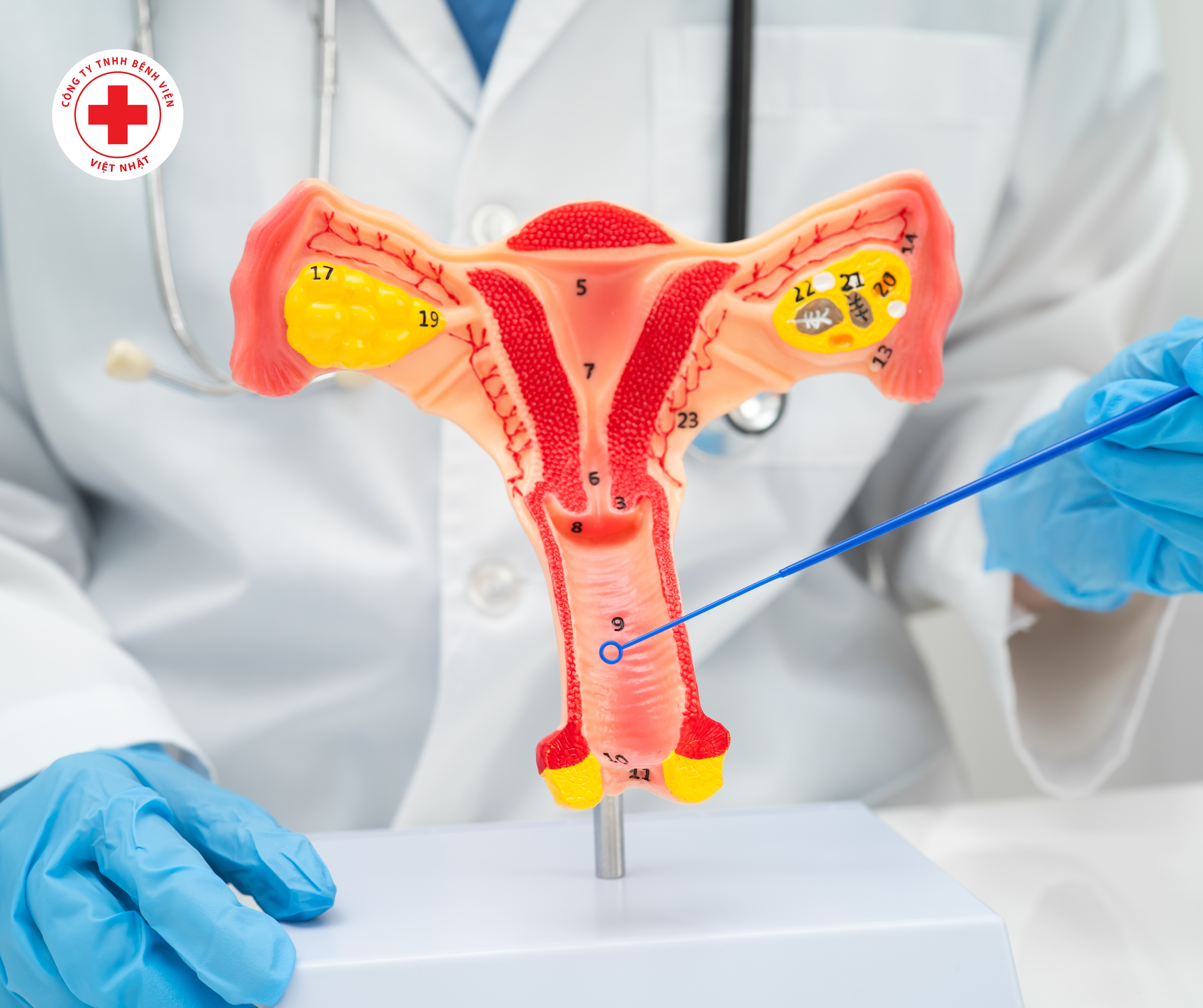 CÔ GÁI 23 TUỔI PHÁT HIỆN BỆNH UNG THƯ CỔ TỬ CUNG SỚM NHỜ KHÁM SỨC KHỎE ĐỊNH KỲ