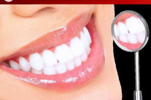 TIỄN TÁO VỀ TRỜI – RĂNG SÁNG NGỜI ĐÓN LỘC : Bí quyết nụ cười trắng sáng – Không đau, không ê buốt