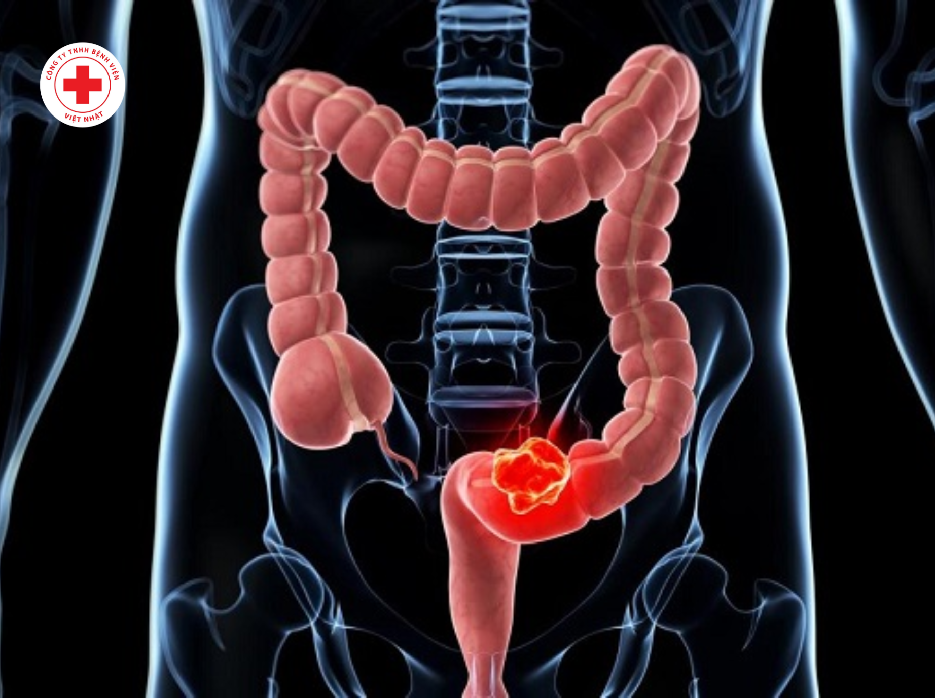 Những thắc mắc thường gặp khi muốn nội soi tiêu hóa