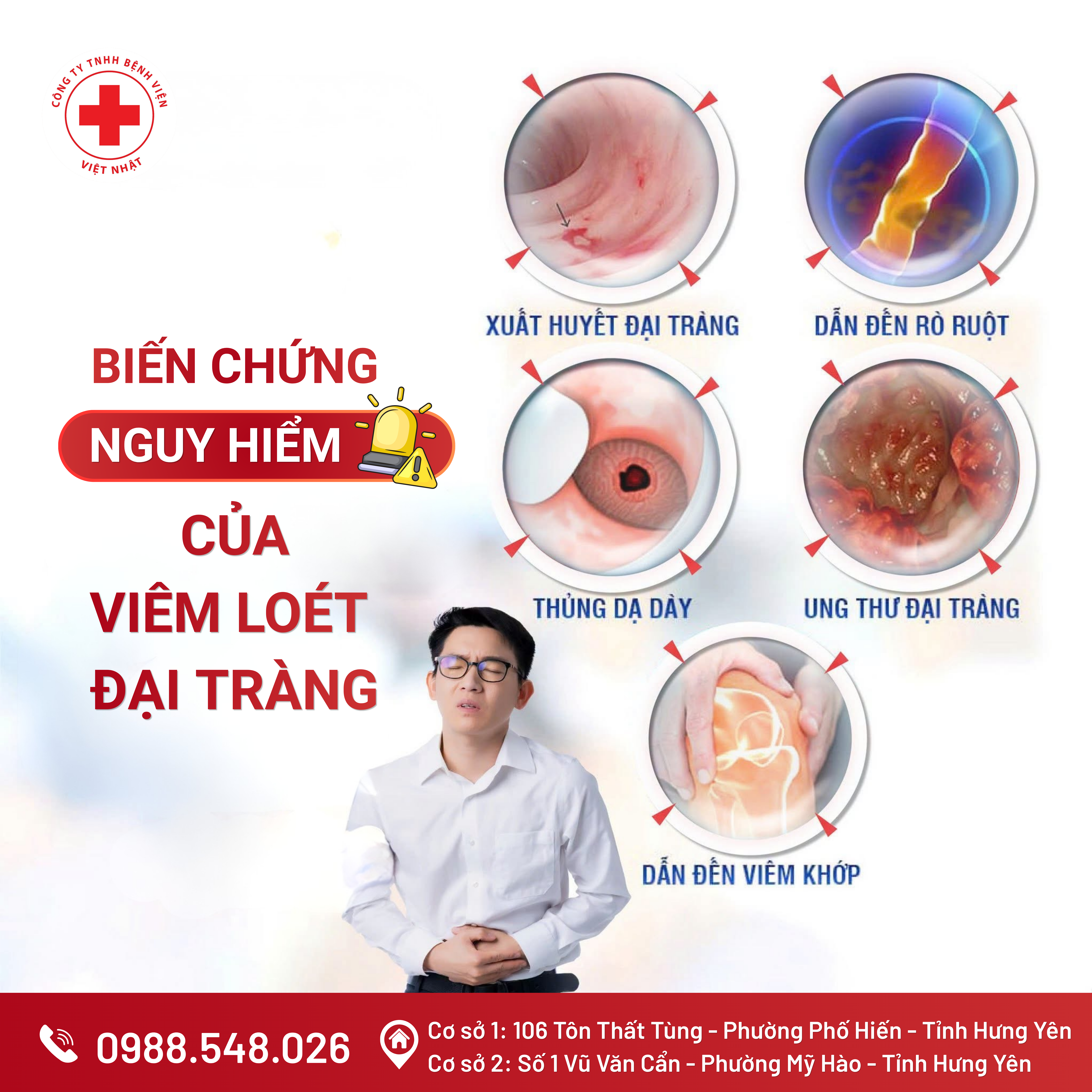 VIÊM LOÉT ĐẠI TRÀNG CÓ NGUY HIỂM KHÔNG? 5 BIẾN CHỨNG